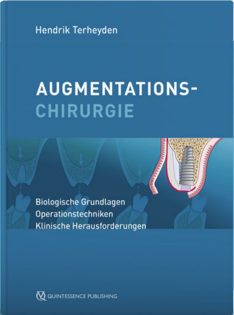 Das neue Lehrbuch der Augmentation für Ärzte und Patienten